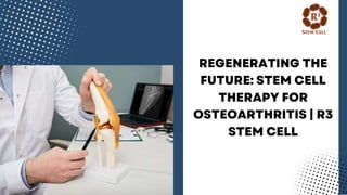 Regenerating the Future: Stem Cell Therapy for Osteoarthritis | R3 Stem Cell