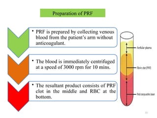 35
Preparation of PRF
• PRF is prepared by collecting venous
blood from the patient’s arm without
anticoagulant.
• The blood is immediately centrifuged
at a speed of 3000 rpm for 10 mins.
• The resultant product consists of PRF
clot in the middle and RBC at the
bottom.
 