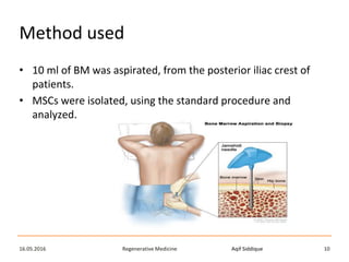 Aqif SiddiqueRegenerative Medicine16.05.2016 10
Method used
• 10 ml of BM was aspirated, from the posterior iliac crest of
patients.
• MSCs were isolated, using the standard procedure and
analyzed.
 