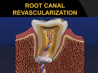ROOT CANAL
REVASCULARIZATION
 