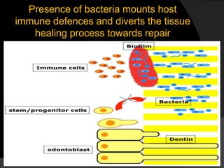 Presence of bacteria mounts host
immune defences and diverts the tissue
healing process towards repair
 