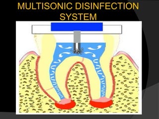 MULTISONIC DISINFECTION
SYSTEM
 