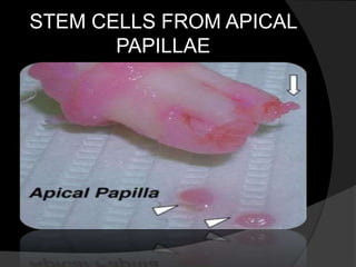 STEM CELLS FROM APICAL
PAPILLAE
 