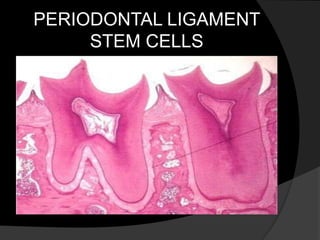 PERIODONTAL LIGAMENT
STEM CELLS
 
