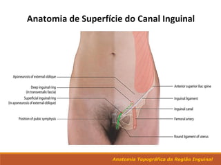 Anatomia Topográfica da Região Inguinal
 