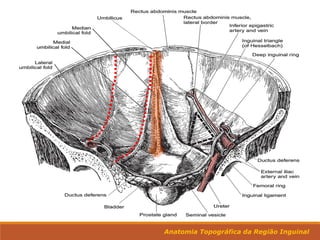 Anatomia Topográfica da Região Inguinal
 