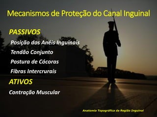 Mecanismos de Proteção do Canal Inguinal
Anatomia Topográfica da Região Inguinal
PASSIVOS
Posição dos Anéis Inguinais
Tendão Conjunto
Postura de Cócoras
Fibras Intercrurais
ATIVOS
Contração Muscular
 