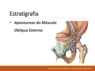Anatomia Topográfica da Região Inguinal
Estratigrafia
 