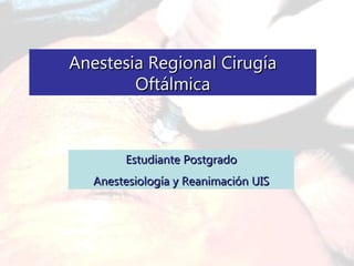 Anestesia Regional Cirugía Oftálmica Estudiante Postgrado Anestesiología y Reanimación UIS 
