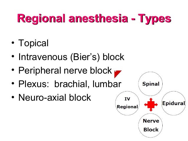 Regional Anesthesia Regional Anesthesia