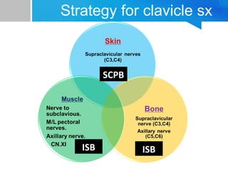 Strategy for clavicle sx 
ISB 
SCPB 
ISB 
 