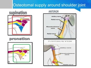 Osteotomal supply around shoulder joint 
 