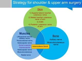 Strategy for shoulder & upper arm surgery 
Interscalene block 
 