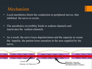 Regional anesthesia by Dr. Ali Mujtaba | PPTX