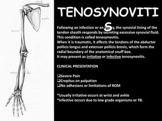 Sheathing Injury Regional conditions of upper limb | PPTX