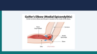 Comprehensive Overview of Upper Extremity Regional Conditions: Shoulder ...