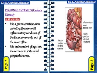 Caseating Definition Regional enteritis (crohn’s disease) by Dr.AmrithaAnilkumar | PPTX