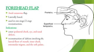 Regional flap Reconstruction in Head & Neck Surgeries | PPTX