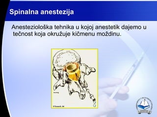 Spinalna anestezija Anesteziolo?ka tehnika u kojoj anestetik dajemo u te?nost koja okru?uje ki?menu mo?dinu.  