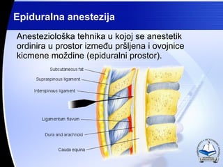 Anesteziolo?ka tehnika u kojoj se anestetik ordinira u prostor izme?u pr?ljena i ovojnice kicmene mo?dine (epiduralni prostor).  Epiduralna anestezija 
