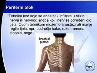 Tehnika kod koje se anestetik infiltrira u blizinu  nerva ili nervnog snopa koji inervi?e odre?eni dio tjela. Ovom tehnikom mo?emo anestezirati manje regije tjela, npr. podru?je ?ake, ruke, ramena, stopala, noge ... Periferni blok 