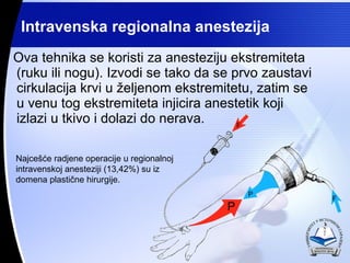 Ova tehnika se koristi za anesteziju ekstremiteta (ruku ili nogu). Izvodi se tako da se prvo zaustavi cirkulacija krvi u ?eljenom ekstremitetu, zatim se u venu tog ekstremiteta injicira anestetik koji izlazi u tkivo i dolazi do nerava. Intravenska regionalna anestezija Najce??e radjene operacije u regionalnoj intravenskoj anesteziji (13,42%) su iz domena plasti?ne hirurgije. 