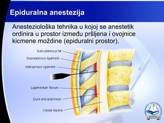 <ul><li>Anesteziološka tehnika u kojoj se anestetik ordinira u prostor između pršljena i ovojnice kicmene moždine (epidura...