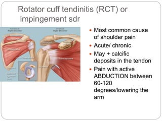 Regional Rheumatic Pain Syndromes | PPTX