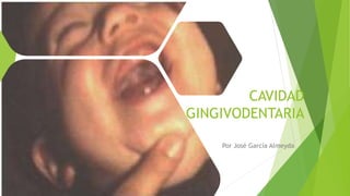 CAVIDAD
GINGIVODENTARIA
Por José García Almeyda
 