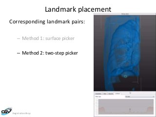 Landmark placement 
Corresponding landmark pairs: 
– Method 1: surface picker 
– Method 2: two-step picker 
RegistrationShop Noeska Smit 
 