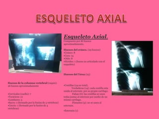 Esqueleto Axial.
Compuesto por 80 huesos
aproximadamente,
Huesos del cráneo. (29 huesos)
•Cráneo: 8
•Cara: 14
•Oído: 8
•Hioides: 1 (hueso no articulado con el
esqueleto)
Huesos de la columna vertebral (raquis):
26 huesos aproximadamente
•Cervicales (cuello): 7
•Torácicos: 12
•Lumbares: 5
•Sacro: 1 (formado por la fusión de 5 vértebras)
•Cóccix: 1 (formado por la fusión de 4
vértebras)
Huesos del Tórax (25)
•Costillas (24 en total).
Verdaderas (14): cada costilla esta
unida al esternón por su propio cartílago.
Falsas (6): las costillas se unen
todas juntas al esternón por medio de un
mismo cartílago.
Flotantes (4): no se unen al
esternón.
•Esternón (1)
 