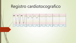 Registro cardiotocografico
 