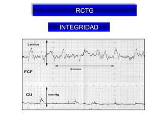 R Ctg REGISTRO CARDIOTOCOGRAFICO 2.pptx