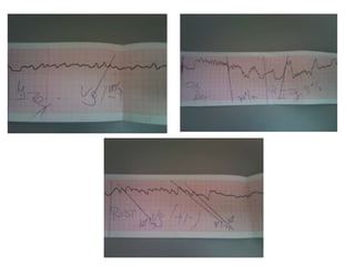 Registro eng silla rot