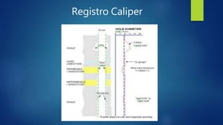 Registro Caliper
 