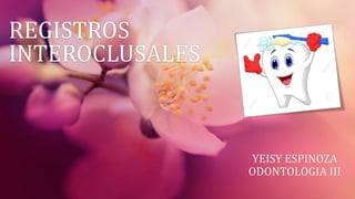 REGISTROS
INTEROCLUSALES
YEISY ESPINOZA
ODONTOLOGIA III
 