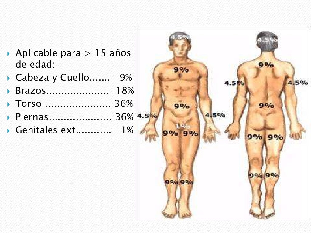 Regla de los 9 Regla de los 9