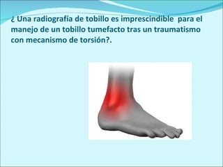 ¿ Una radiografía de tobillo es imprescindible  para el manejo de un tobillo tumefacto tras un traumatismo con mecanismo de torsión?. 