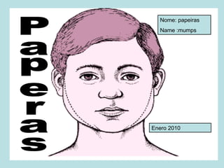 Paperas Enero 2010 Nome: papeiras Name :mumps 