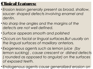 Sharp Linear Defect Tooth Regressive alterations of teeth | PPT