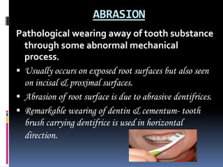 REGRESSIVE ALTERATIONS OF THE TEETH.pptx
