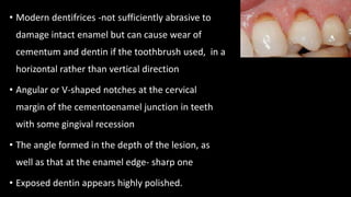 Regressive alterations of the teeth.pptx