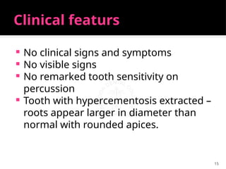 15
Clinical featurs
 No clinical signs and symptoms
 No visible signs
 No remarked tooth sensitivity on
percussion
 Tooth with hypercementosis extracted –
roots appear larger in diameter than
normal with rounded apices.
 