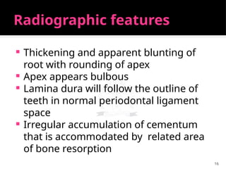 16
Radiographic features
 Thickening and apparent blunting of
root with rounding of apex
 Apex appears bulbous
 Lamina dura will follow the outline of
teeth in normal periodontal ligament
space
 Irregular accumulation of cementum
that is accommodated by related area
of bone resorption
 