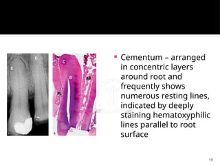 19
 Cementum – arranged
in concentric layers
around root and
frequently shows
numerous resting lines,
indicated by deeply
staining hematoxyphilic
lines parallel to root
surface
 