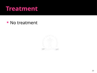 20
Treatment
 No treatment
 