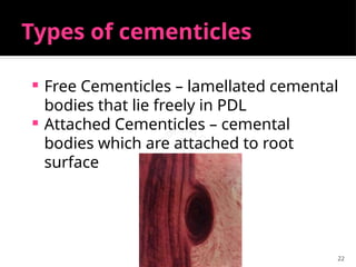 22
Types of cementicles
 Free Cementicles – lamellated cemental
bodies that lie freely in PDL
 Attached Cementicles – cemental
bodies which are attached to root
surface
 