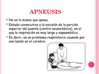 ENFERMERIA EN REGULACION DE LA RESPIRACION I.ppt