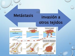 Metástasis invasión a
otros tejidos
 
