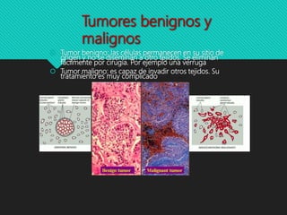 Tumores benignos y
malignos
 Tumor benigno: las células permanecen en su sitio de
origen y no se diseminan a otro tejidos. Se eliminan
fácilmente por cirugía. Por ejemplo una verruga
 Tumor maligno: es capaz de invadir otros tejidos. Su
tratamiento es muy complicado
 